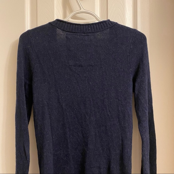 Hollister - Navy Button-up Cardigan - Picture 7 of 7